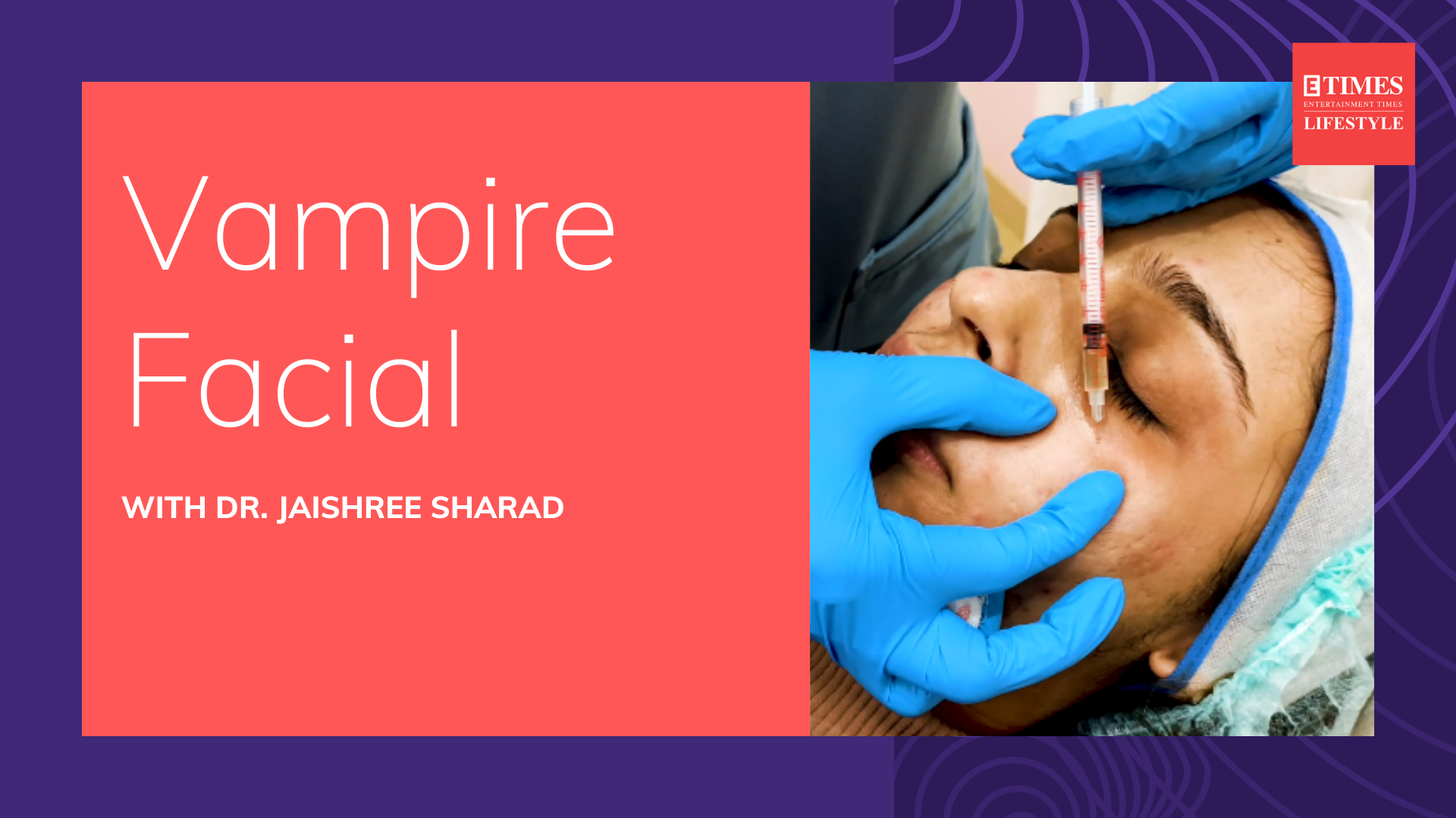 We tried the Vampire Facial | Lifestyle - Times of India Videos