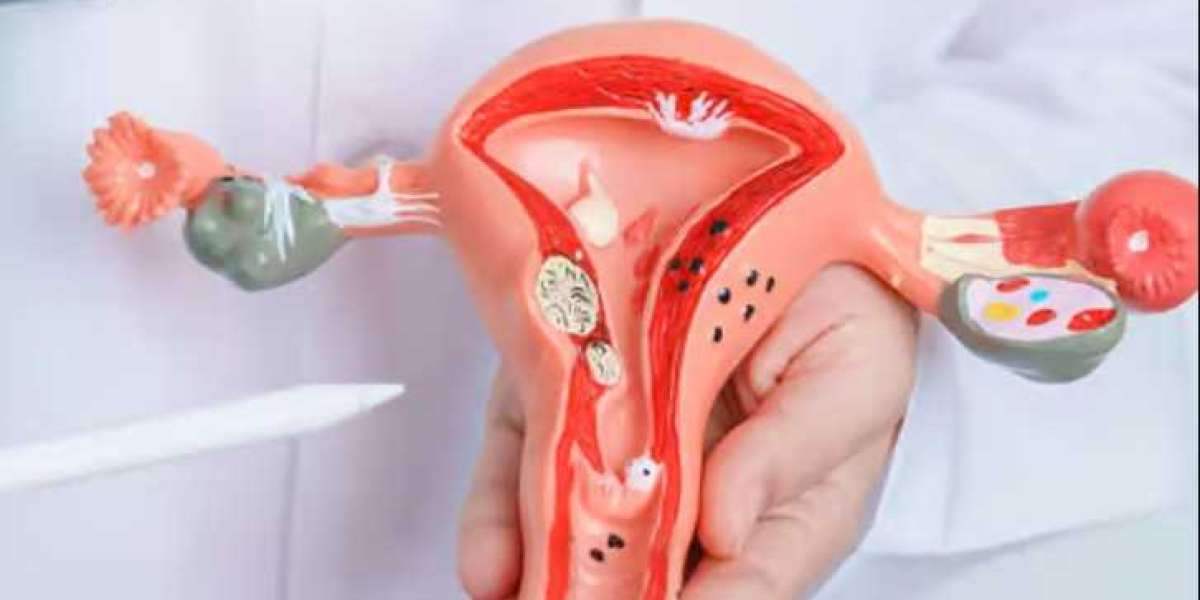 Menopause Treatment In Dubai: Personalized Support for Hormonal Wellbeing