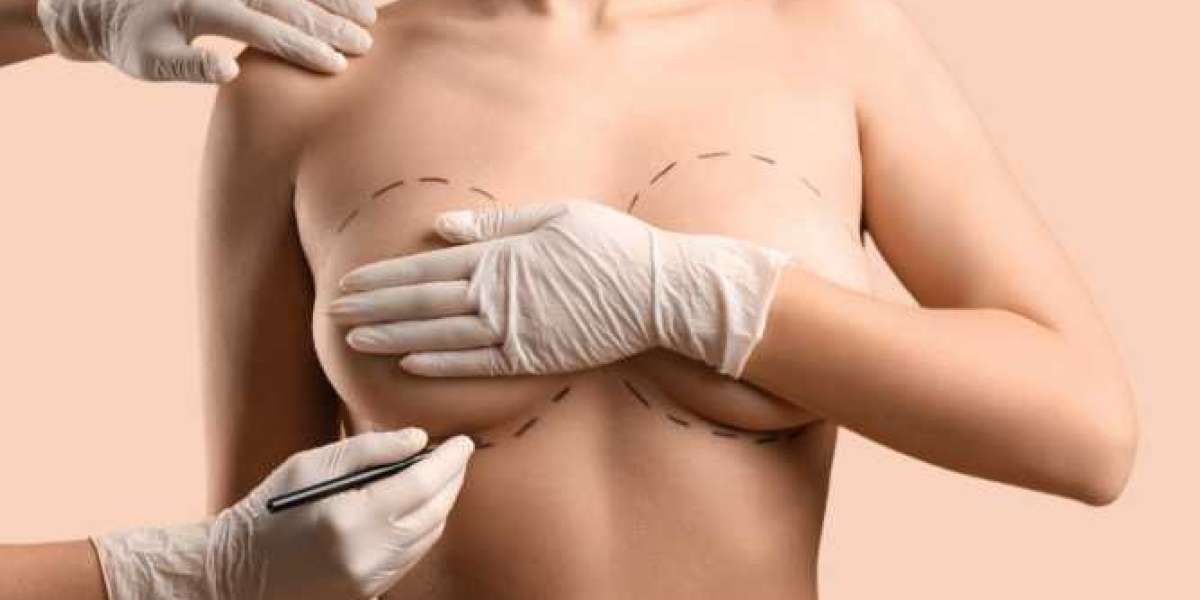 Breast Augmentation In Dubai: Natural-Looking Breast Results
